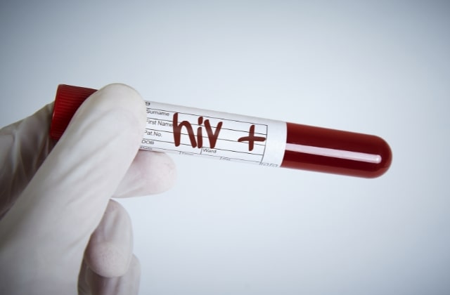 Casos de HIV/aids