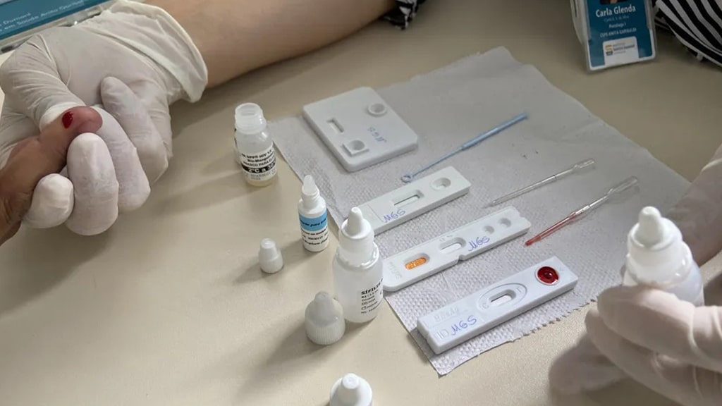 Teste rápido de HIV e sífilis será incluído ao SUS